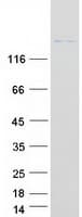 Human DOCK8 Protein (Recombinant Myc-DDK (Flag))