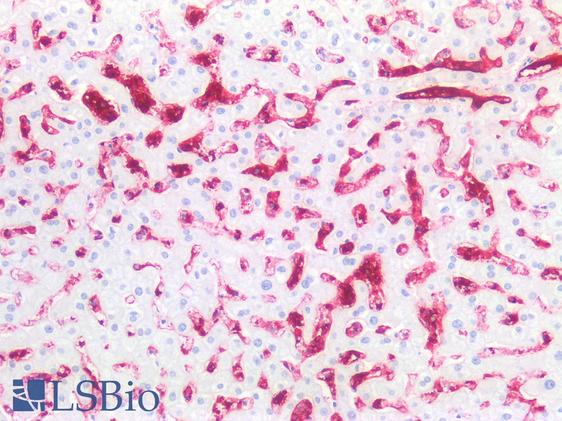 IHC-plus™ Blood Group A Antibody (clone B480)