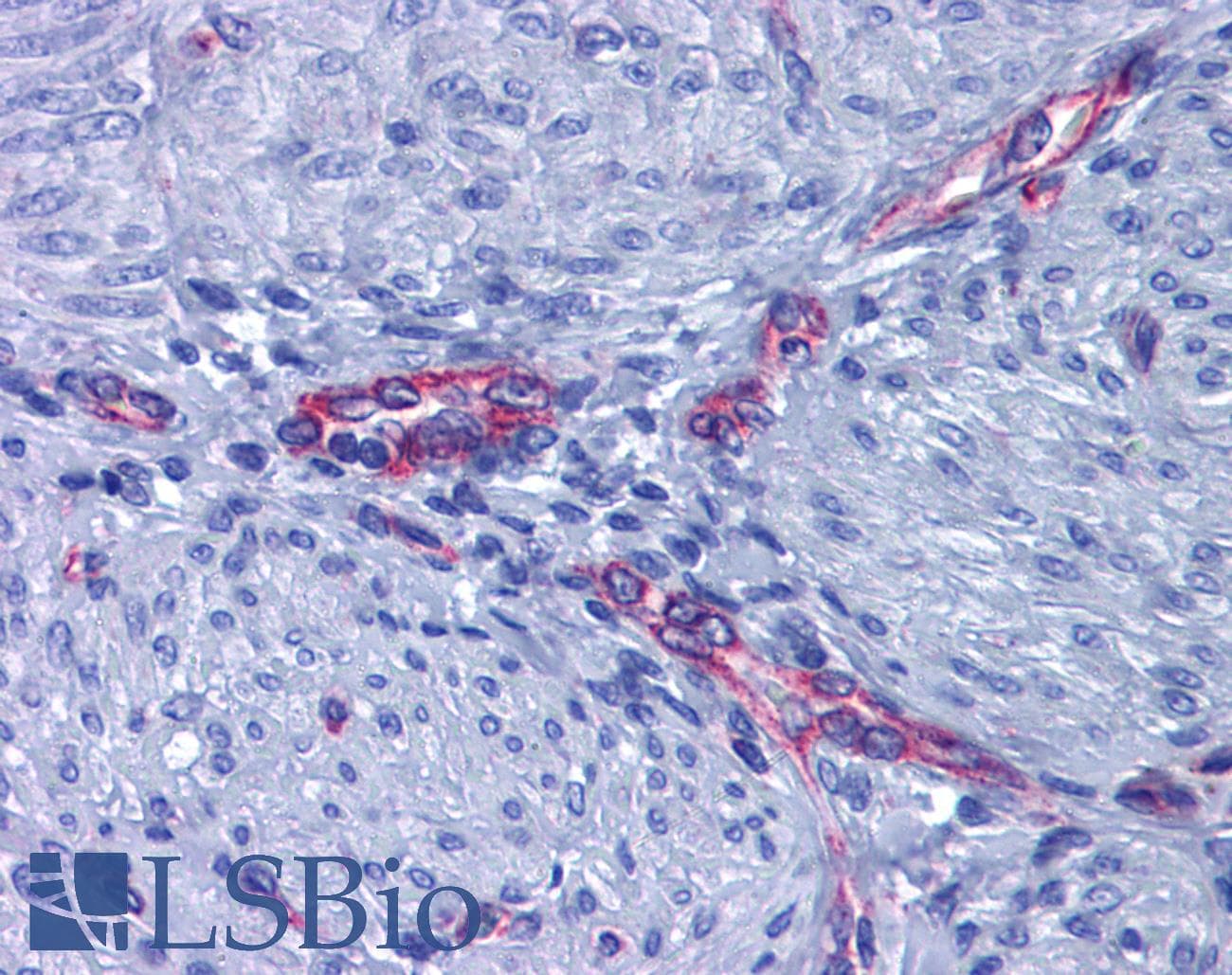 IHC-plus™ Polyclonal Rabbit anti-Human PTGER2 / EP2 Antibody (aa261-310, IHC, WB)