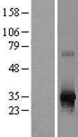 RPIA / RPI Protein (Over-Expression Lysate Myc-DDK (Flag))