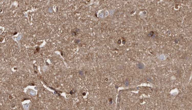 Polyclonal Rabbit anti-Human ZNRF1 Antibody (IHC, IF, WB)