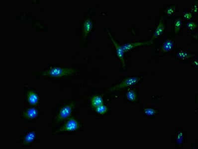 Polyclonal Rabbit anti-Human AURKC / Aurora C Antibody (IHC, IF, WB)