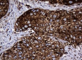 PathPlus™ HSPD1 / HSP60 Antibody (clone OTI3A2)