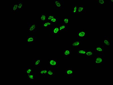HIST1H1E Antibody (phospho-Ser35)