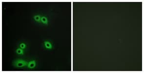 EMA / MUC1 Antibody (aa1191-1240)