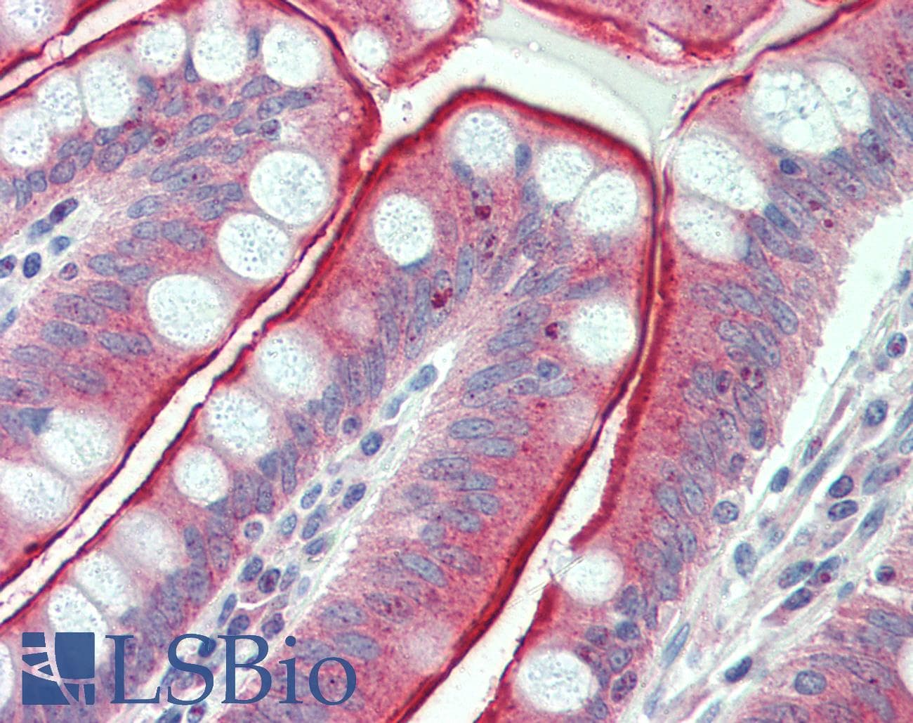 IHC-plus™ Polyclonal Rabbit anti-Human CDHR5 / MUCDHL Antibody (Internal)