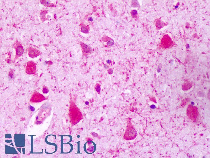 IHC-plus™ GPRC5A / RAI3 Antibody (C-Terminus)