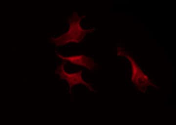LYN Antibody