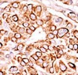 PIKFYVE / PIP5K Antibody (aa1531-1561)