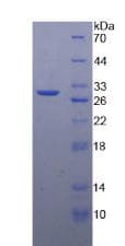 Human MMP24 Protein (Recombinant His-T7)