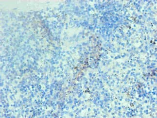Monoclonal Mouse anti-Human Hemoglobin Antibody (clone 4A1B1, IHC)