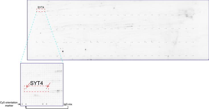 Monoclonal Mouse anti-Human SYT4 Antibody (clone UMAB128, Carrier-free, IHC, IF)