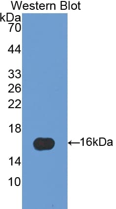 E-FABP / FABP5 Antibody (aa2-135)