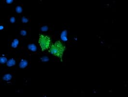Monoclonal Mouse anti-Human UNG / Uracil DNA Glycosylase Antibody (clone OTI1G1, IHC, IF, WB)