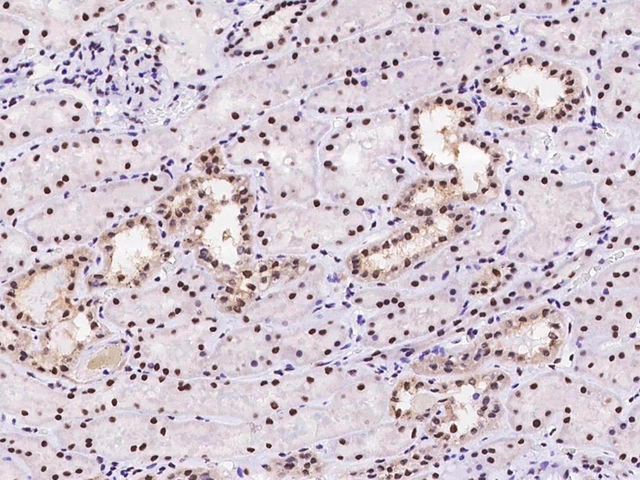 Polyclonal Rabbit anti-Human PIN4 Antibody (IHC)