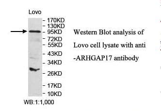 ARHGAP17 / NADRIN Antibody (aa2-195)