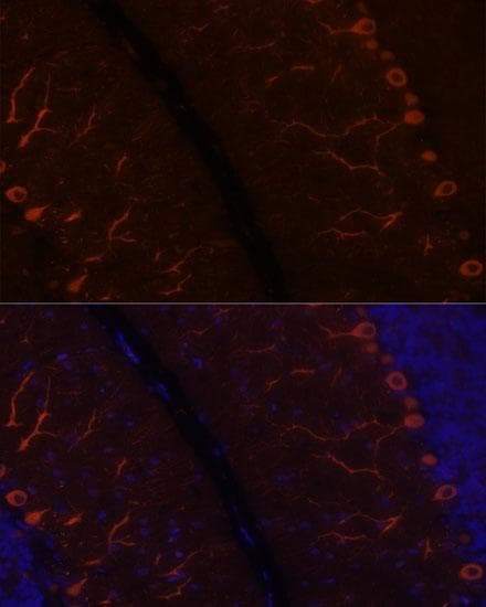 Polyclonal Rabbit anti-Human ANOS1 / Anosmin Antibody (IF)