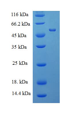 Human MBNL1 / MBNL Protein (Recombinant 6His-SUMO, N-terminus)
