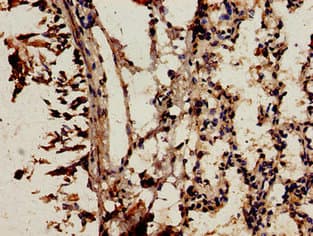 Polyclonal Rabbit anti-Human NCF2 / NOXA2 / p67phox Antibody (IHC, IF, WB)