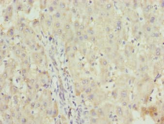 ZNF253 Antibody