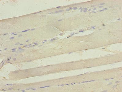 SEPW1 / Selenoprotein W Antibody