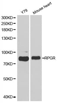 Polyclonal Rabbit anti-Human RPGR Antibody (IHC, WB)