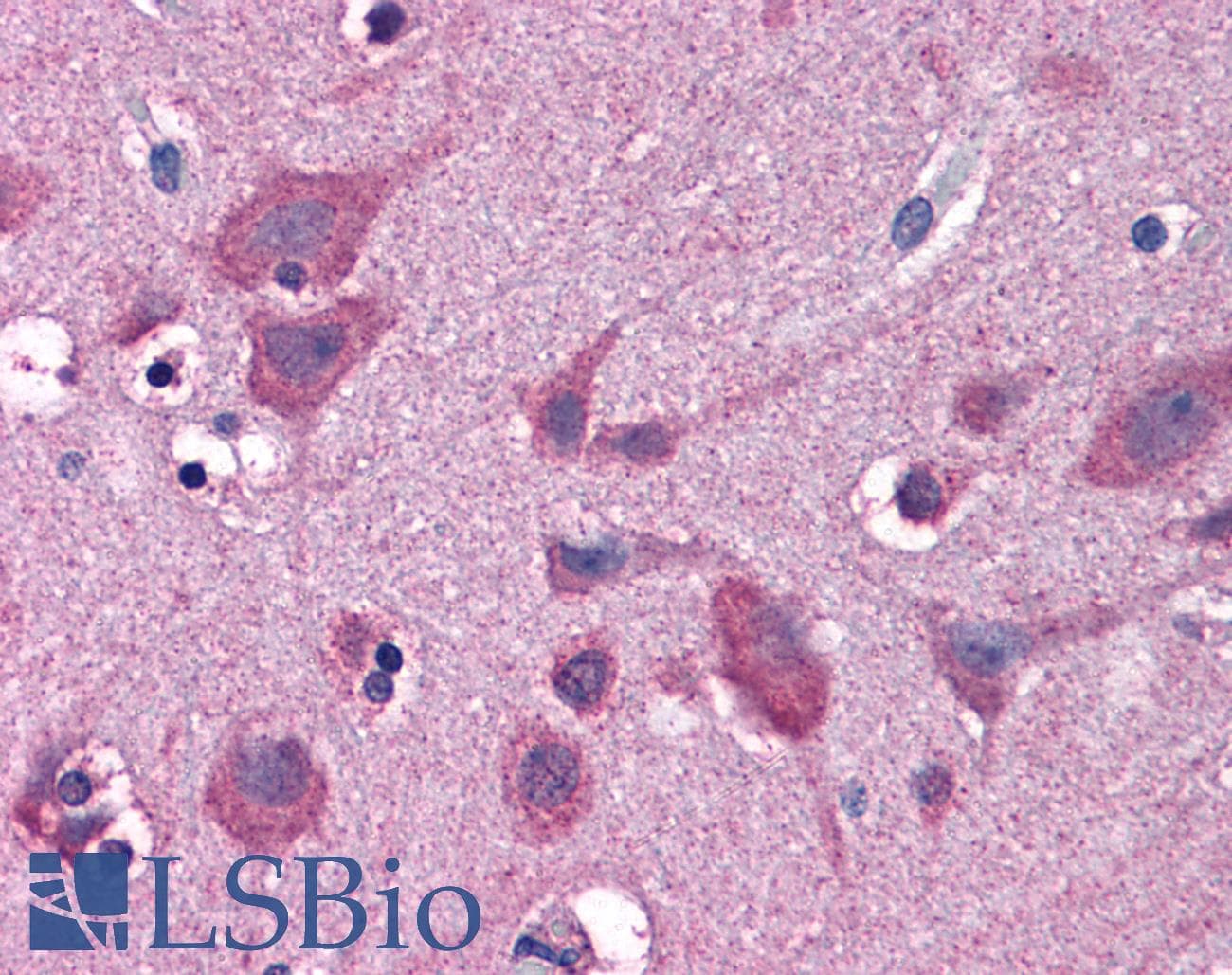 IHC-plus™ Polyclonal Goat anti-Human UBE2K / LIG Antibody (aa144-157, IHC, WB)