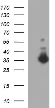 FNDC8 Antibody (clone OTI1C10)