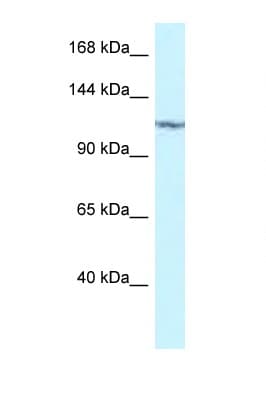 Polyclonal Rabbit anti-Human PKN2 Antibody (aa605-654, WB)