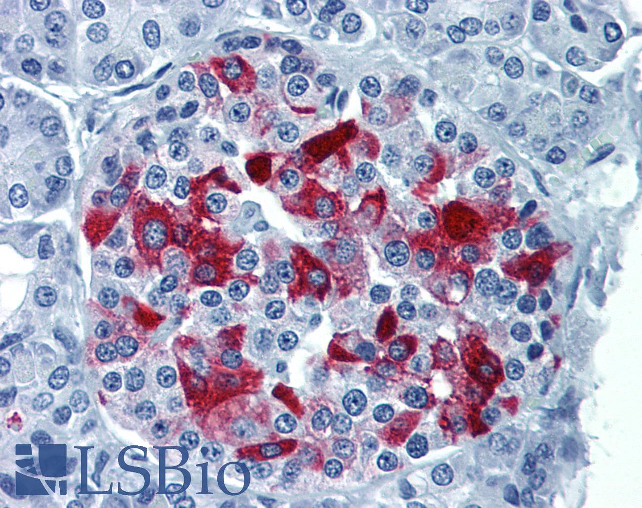 IHC-plus™ Monoclonal Mouse anti-Human RBP4 Antibody (clone 4H7, IHC, WB)