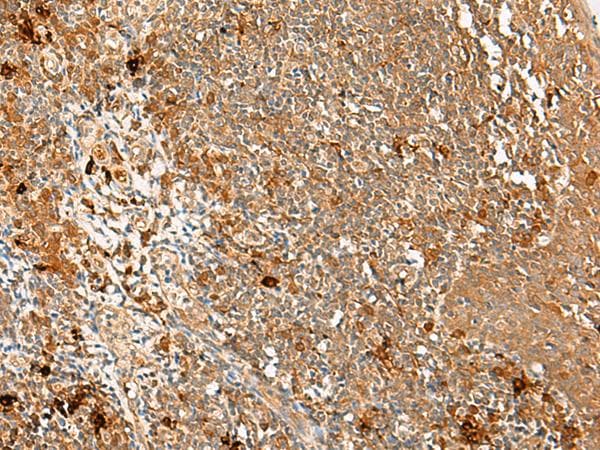 Polyclonal Rabbit anti-Human METT11D1 Antibody (IHC, WB)