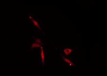 BAZ2A / TIP5 Antibody
