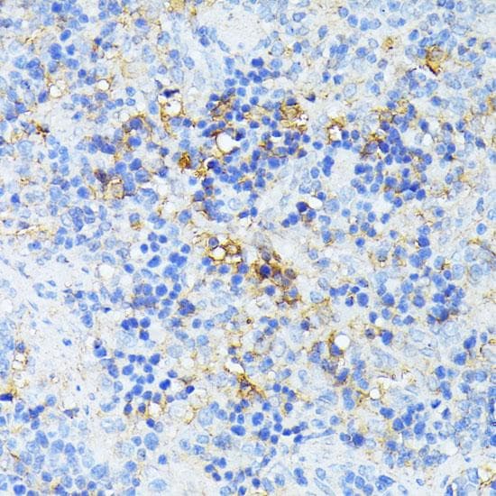 TP53I11 / PIG11 Antibody