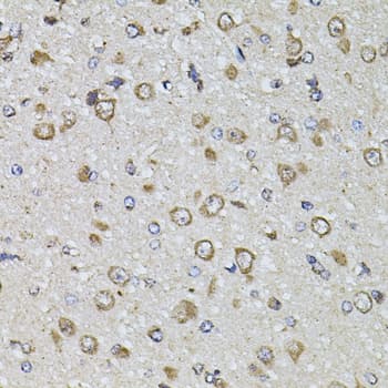 FGF2 / Basic FGF Antibody