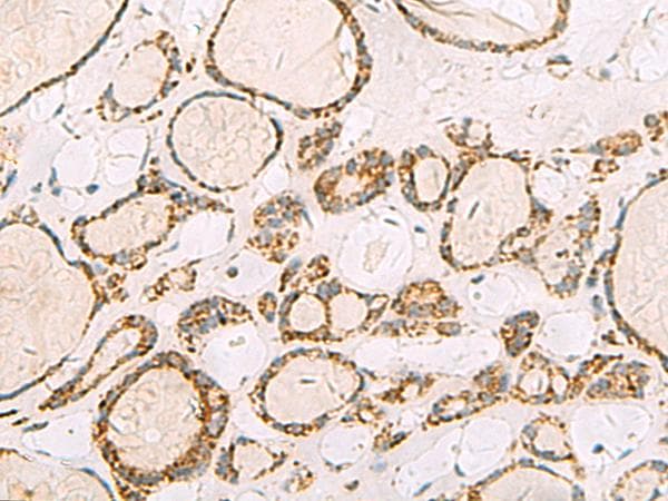 ISOC2 Antibody