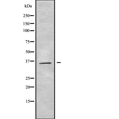 Seven Transmembrane Helix Receptor Antibody