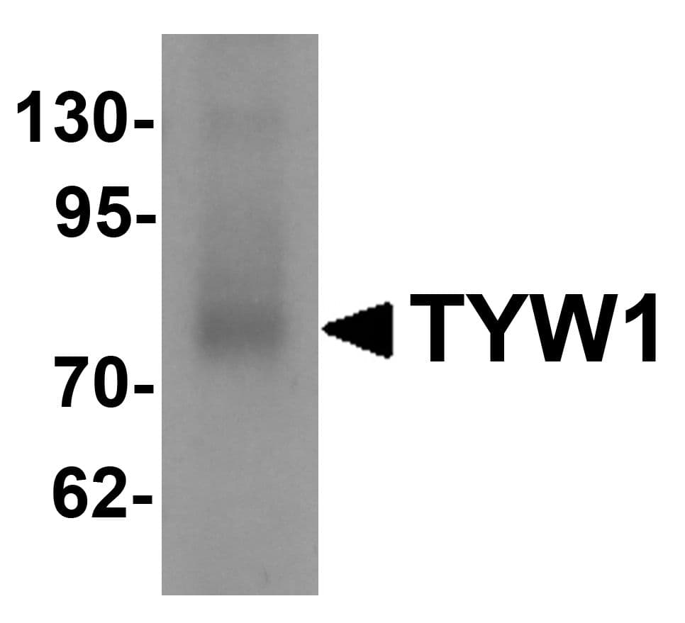 Polyclonal Rabbit anti-Human TYW1 Antibody (IHC, WB)