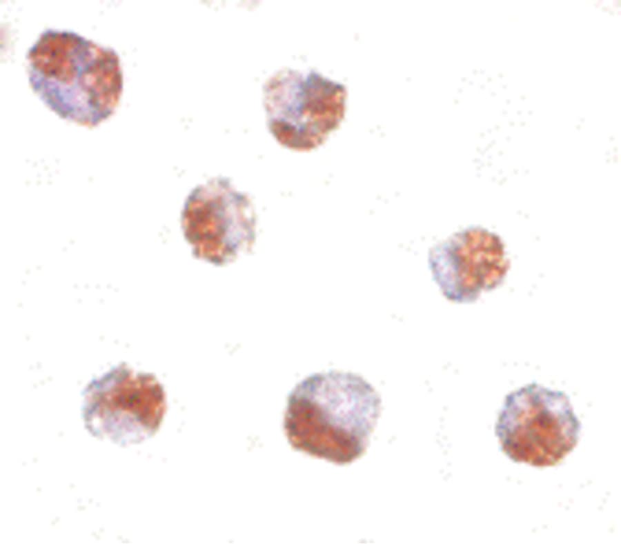 PAK6 Antibody