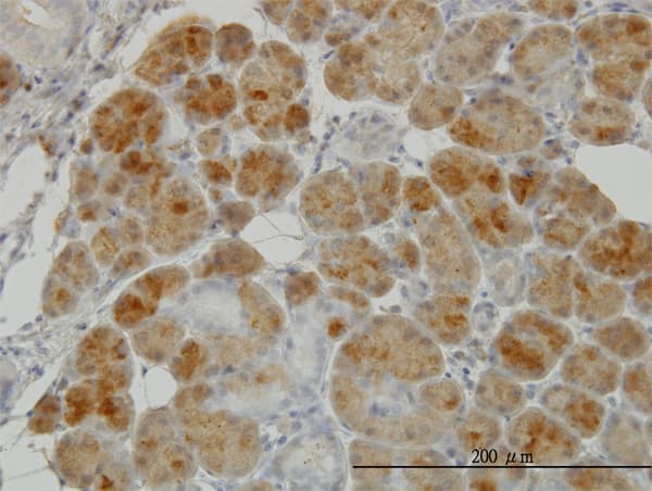 GSR / Glutathione Reductase Antibody (clone 6B4)