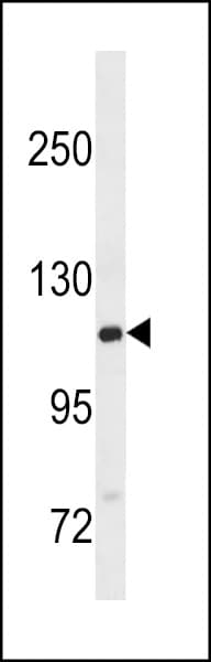 Polyclonal Rabbit anti-Human GTF2IRD2B Antibody (aa467-494, WB)