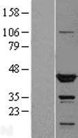 TTL Protein (Over-Expression Lysate Myc-DDK (Flag))