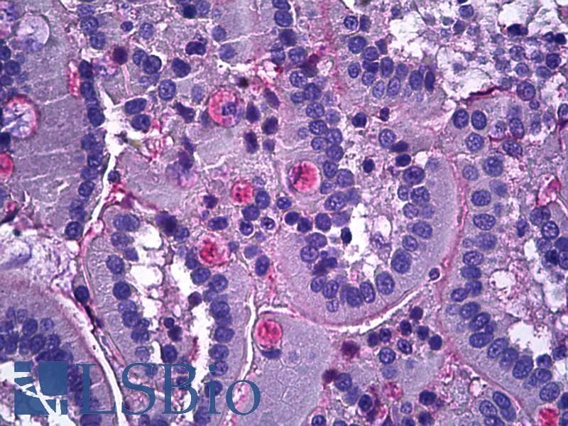 PathPlus™ NTN1 / Netrin 1 Antibody (aa591-604)
