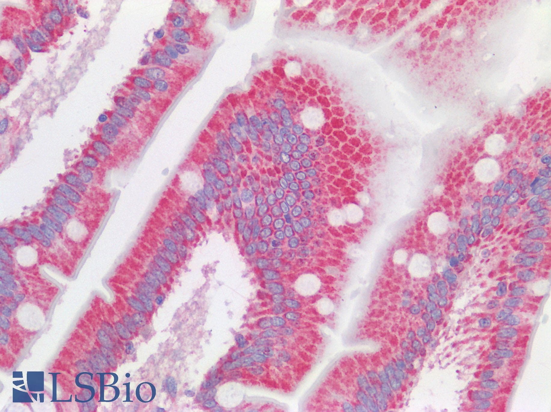 IHC-plus™ VDAC2 Antibody (C-terminal domain of human)