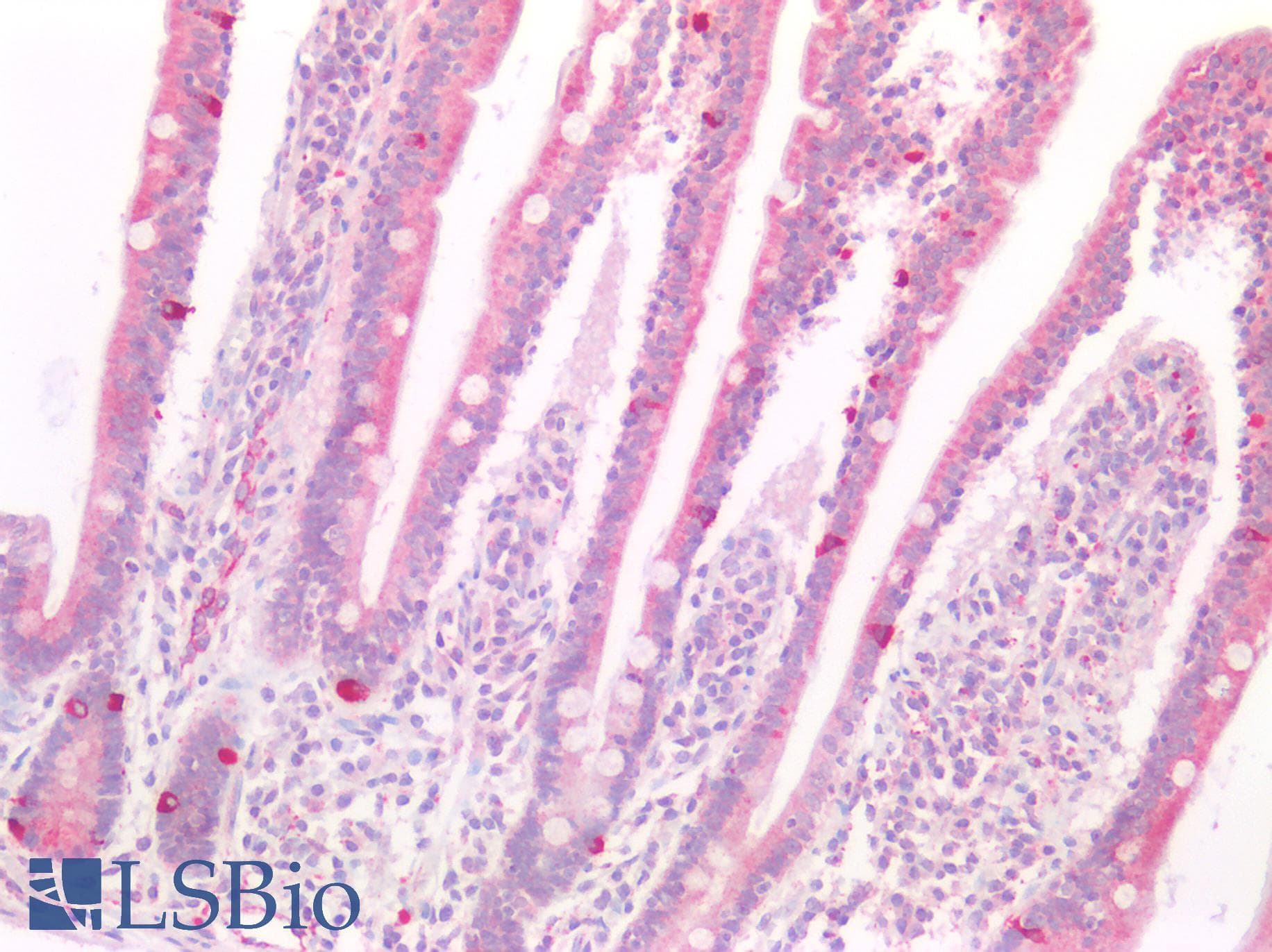 SLIT3 Antibody (aa1405-1512)
