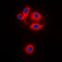 MRPS22 Antibody (Internal)