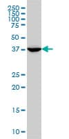 MVD Antibody (clone 2A7)