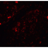 PathPlus™ BECN1 / Beclin-1 Antibody