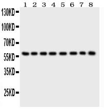 P2RX2 / P2X2 Antibody (aa139-471)