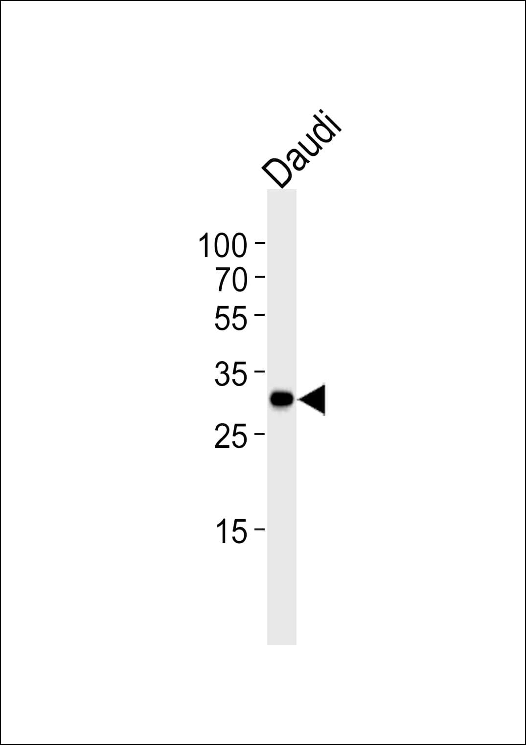 Monoclonal Mouse anti-Human BCL10 / BCL-10 Antibody (clone 1185CT13.2.1.2, aa1-143, IHC, WB)