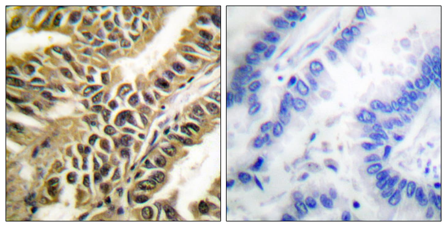 ABL1 / c-ABL Antibody (aa361-410)